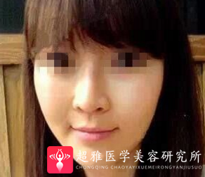 自体脂肪填充术