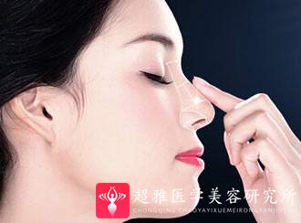 隆鼻手术