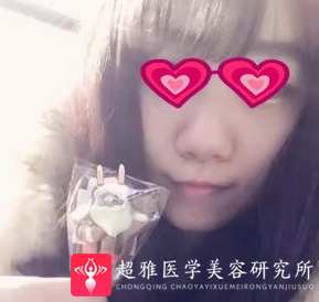 不开刀隆鼻
