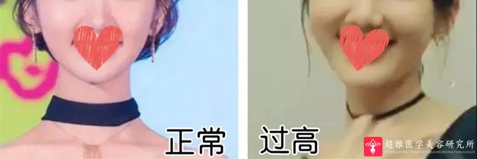 自体脂肪填充术