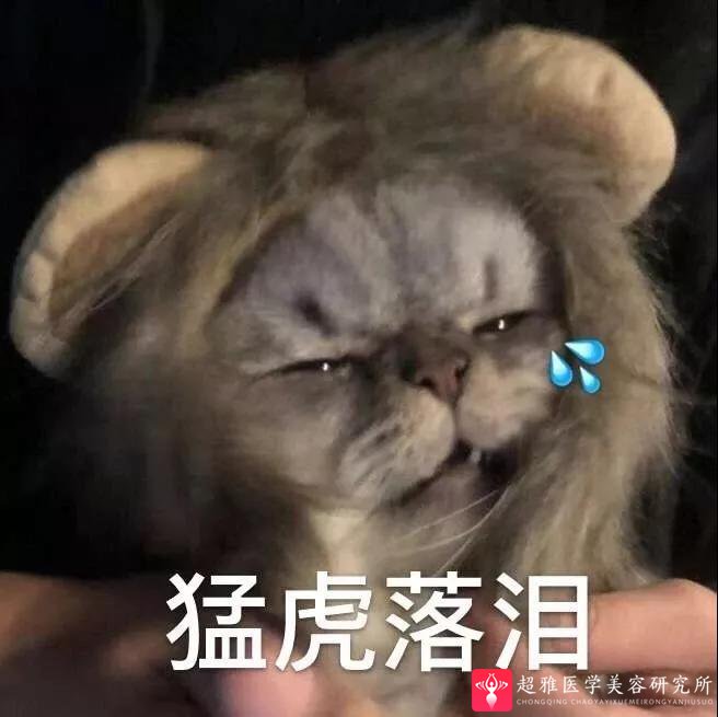 面部提升术