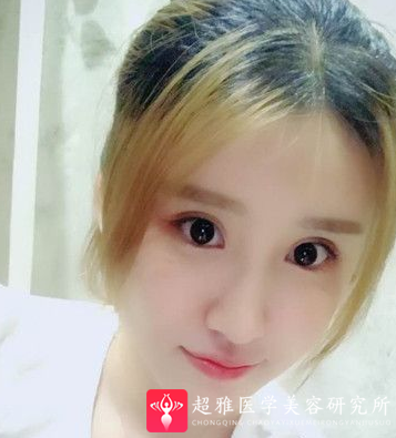 自体脂肪填充术