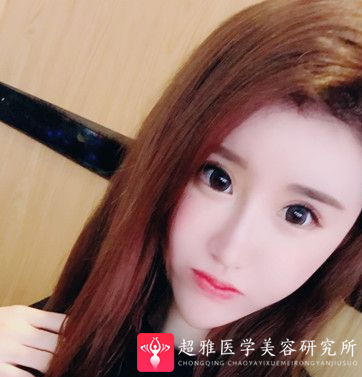 自体脂肪填充术