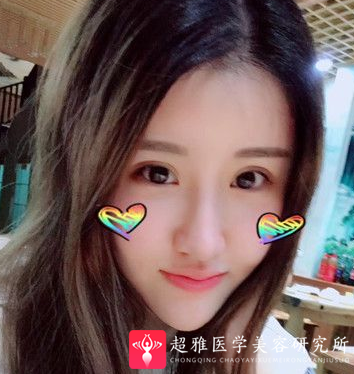 自体脂肪填充术