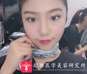 超声波瘦脸