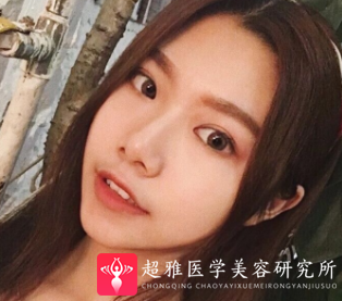 超声波瘦脸