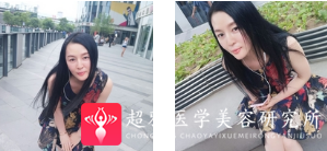 面部提升术