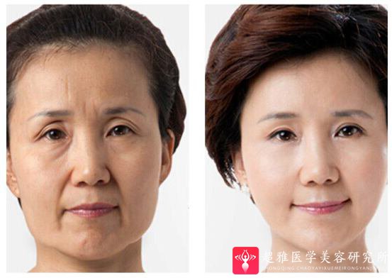重庆超雅