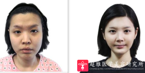 重庆超雅
