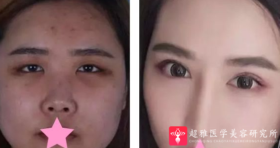 重庆超雅