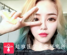 不开刀隆鼻