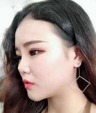 不开刀隆鼻