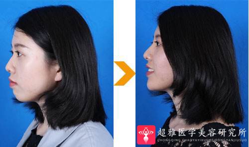 重庆超雅