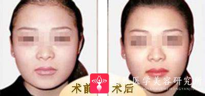 重庆超雅
