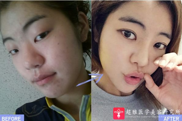 重庆超雅