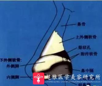 隆鼻手术