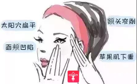 自体脂肪填充术
