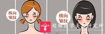 面部提升术