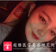 隆鼻手术