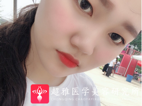 隆鼻手术