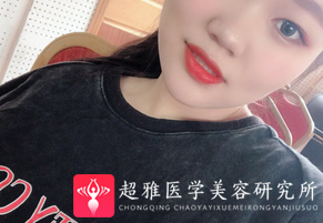 隆鼻手术