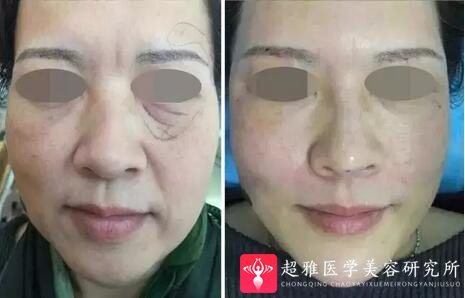 重庆超雅