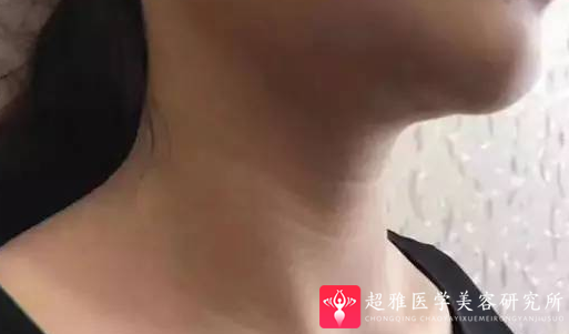 超级微拉美