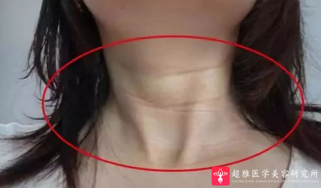 超级微拉美