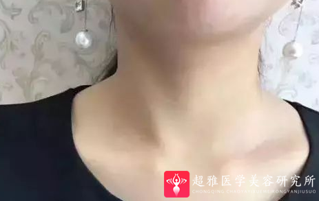 超级微拉美