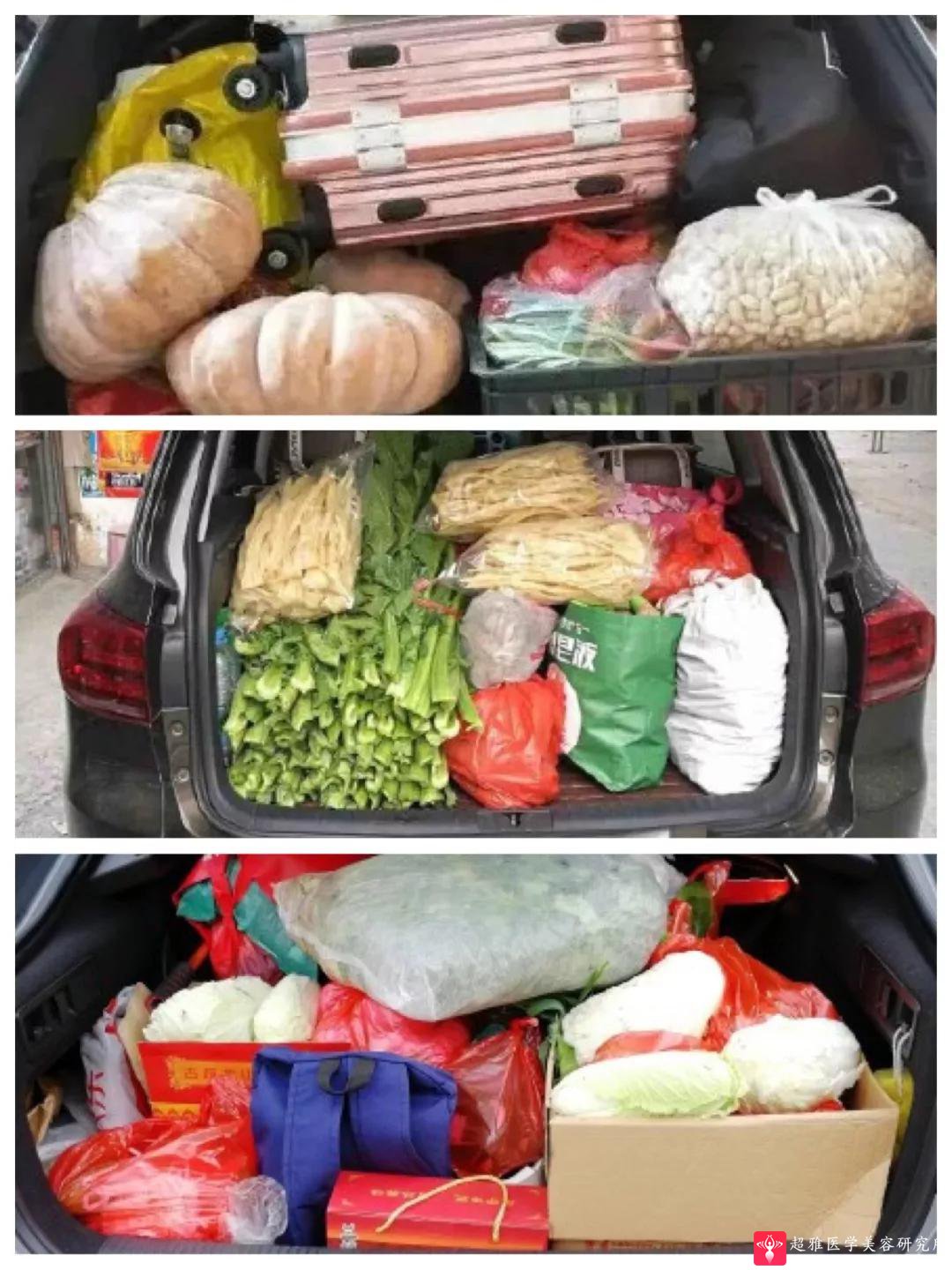 自体脂肪填充术