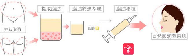 重庆超雅
