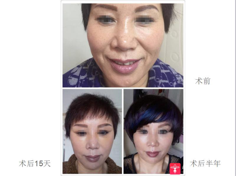 重庆超雅