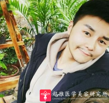 隆鼻手术