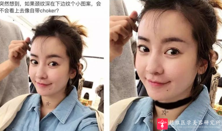超级微拉美