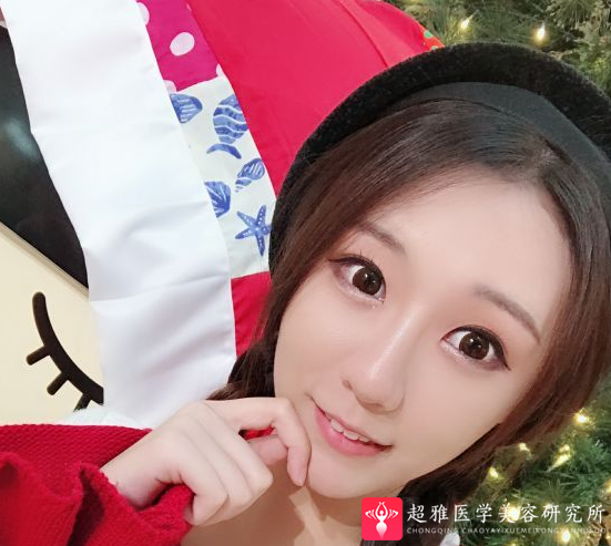 自体脂肪填充术