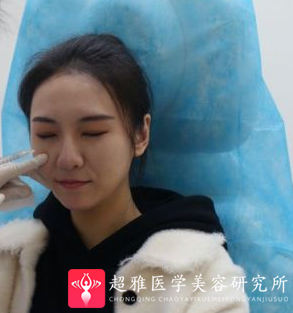 自体脂肪填充术