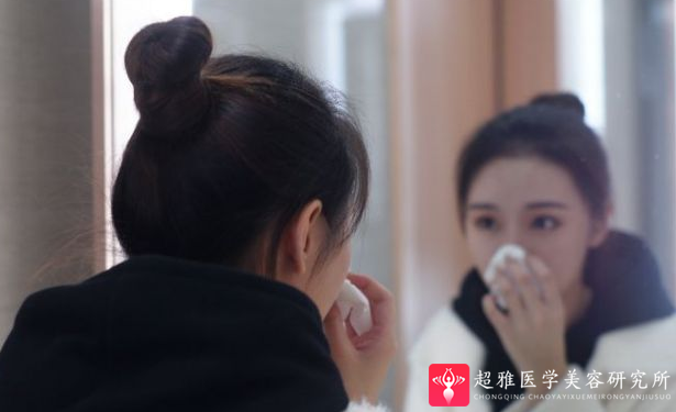 自体脂肪填充术