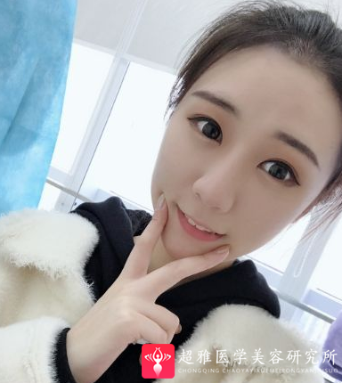 自体脂肪填充术
