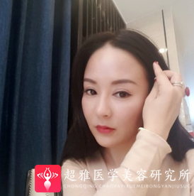 面部提升术