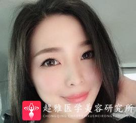 吸脂瘦脸