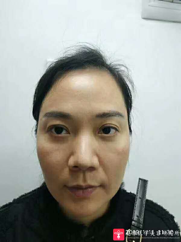 超级微拉美