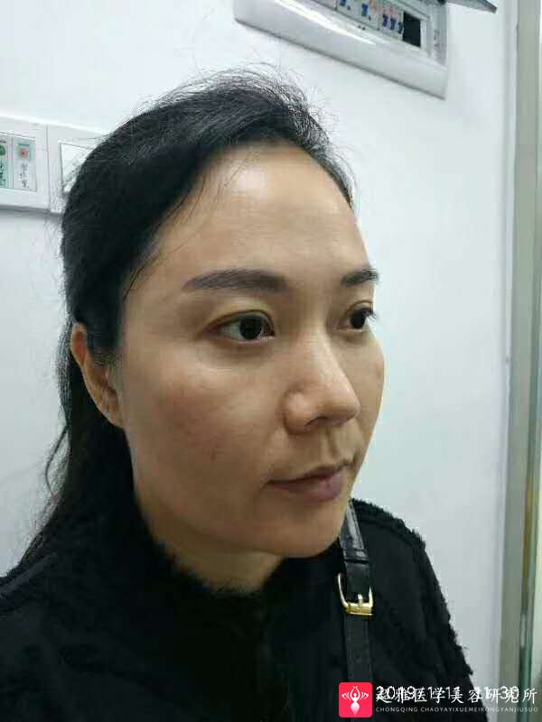 超级微拉美