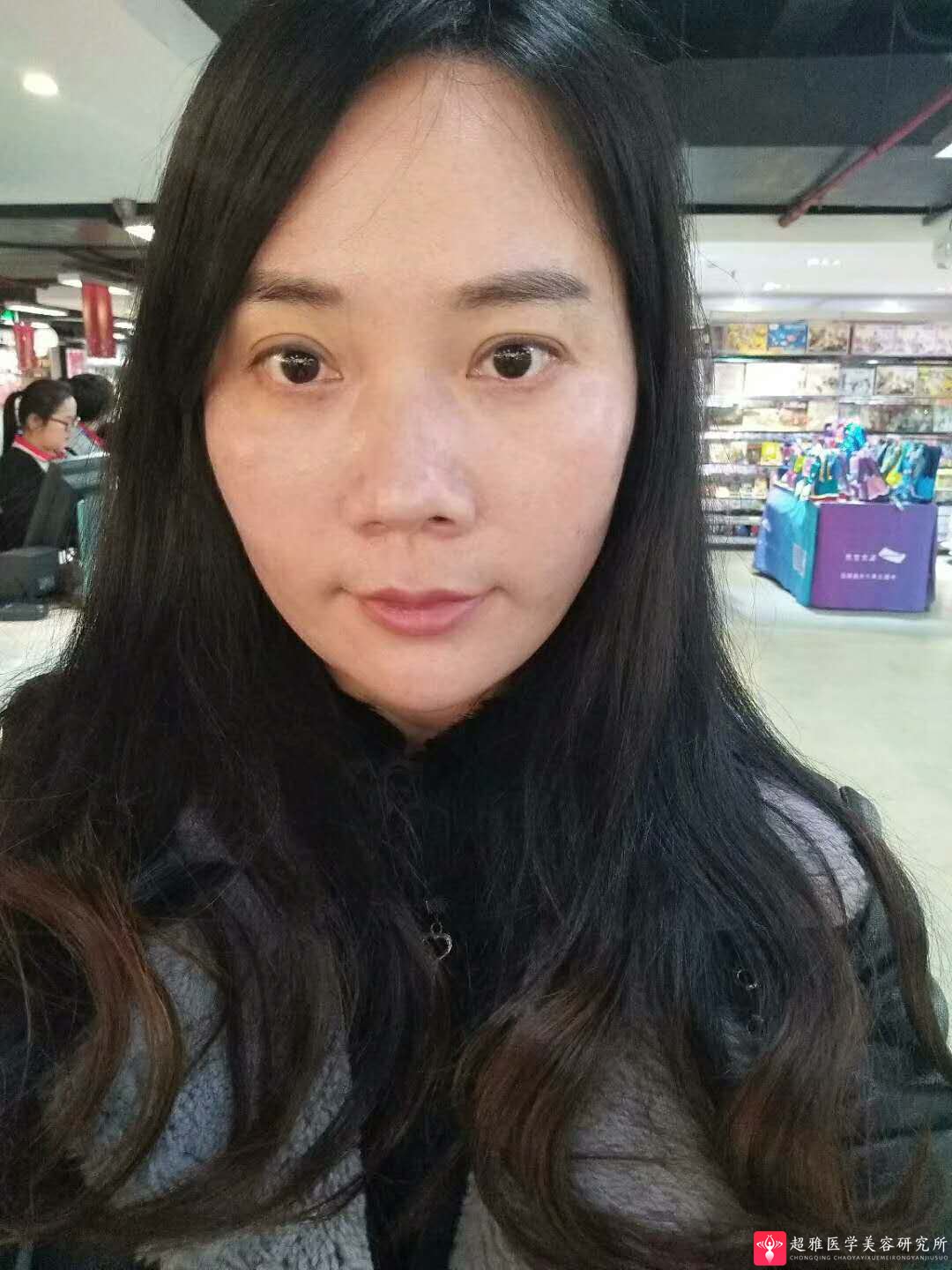 超级微拉美