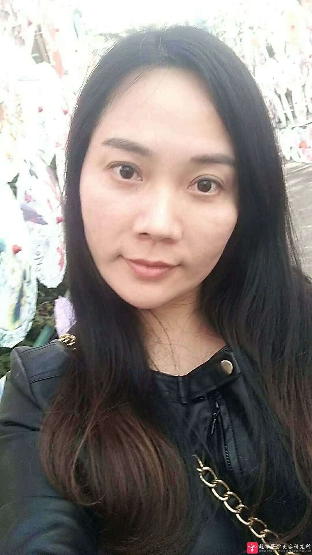 超级微拉美