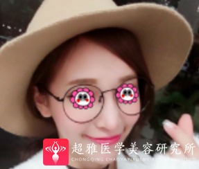 自体脂肪填充术