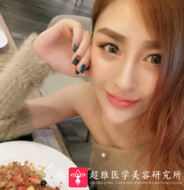 隆鼻手术