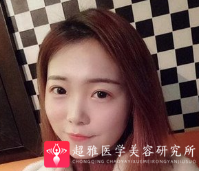 自体脂肪填充术