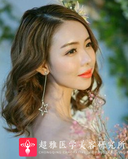 自体脂肪填充术