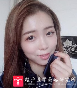 自体脂肪填充术