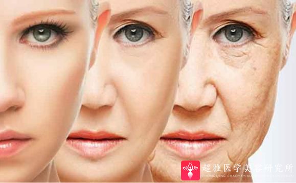 面部提升术